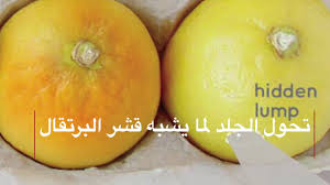 أعراض سرطان الثدي باستخدام الليمون Youtube