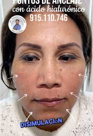 Resultados Naturales en 30 Minutos con Dr. Thomas Guzmán