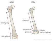 Fracture Education : Anatomic differences: child vs. adult
