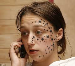 I'm 14 and i am afraid i am thinning in my temples. My Hair Is Falling Out My Hair Is Falling Out Im 14 And Havent
