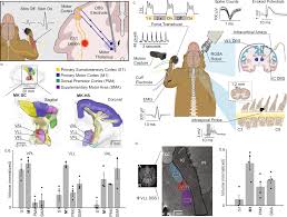 Potentiation of cortico-spinal output via targeted electrical stimulation of  the motor thalamus | Nature Communications
