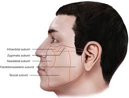 Cheek Plastic Surgery Key