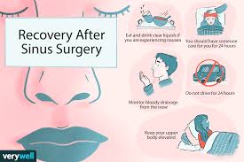 The patient in this period it is forbidden to blow your. Functional Endoscopic Sinus Surgery Prep And Recovery
