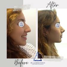 Alfredo Ponce (@docponceplastico) • Instagram photos and videos