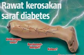 Ubat tradisional kencing manis dan darah tinggi can be fun for anyone. Rawat Kerosakan Saraf Akibat Diabetes V Saraf Gold Perak Facebook