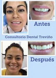 Consultorio Dental Treviño
