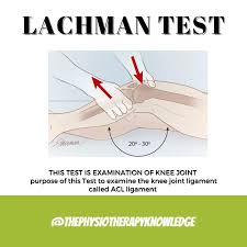 Image result for Lachman Test