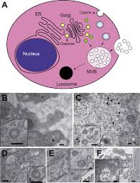 Check spelling or type a new query. Characterizing Viral Infection By Electron Microscopy The American Journal Of Pathology