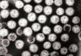 There are many causes, including infection and inflammation. Diarrhea Wikipedia