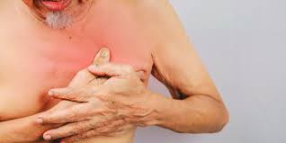 Some men develop rarer types of breast cancer, such as inflammatory breast cancer. Because Men Have Breasts They Can Also Get Breast Cancer Here Are The Symptoms Huffpost Uk