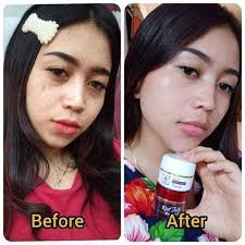 Lebih bagus rk glow atau ms glow. Kalau Ditanyain Bagus Mana Rk Kosmetik Bengkulu Anj Facebook