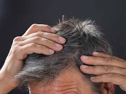 Scientists don't know exactly why some people go gray early, but genes play a large role. What Are The Causes Of Grey Hair Lifealth