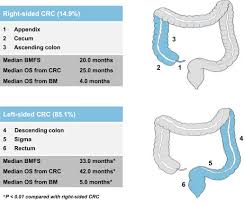 Image result for Primary Tumor Localization