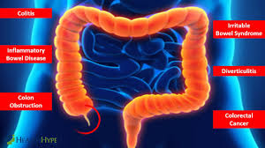 The spleen is associated with the immune system and is located in the left side of your body, above the pancreas. Pain Above Left Hip Causes And Other Symptoms Healthhype Com