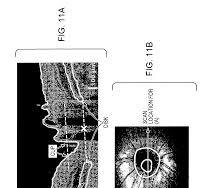 US7884945B2 - Methods and apparatus for optical coherence ...