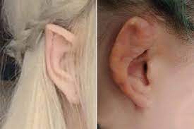 In bloxburg, players will explore the town of bloxburg, chill out with their friends, work with their friends, moreover as style and build their own dream homes and … Elf Ears Are The Creepy New Plastic Surgery Trend In China