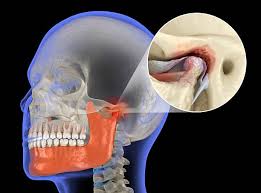 Image result for Jaw Dislocation