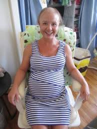 Most of us experience hair loss around the third month after birth, or a little later if you're breastfeeding. I Lost All My Hair During Pregnancy Huffpost Life