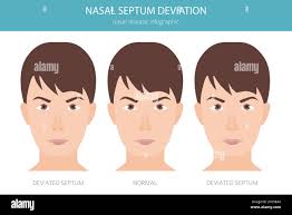 Rhinoscopy hi-res stock photography and images