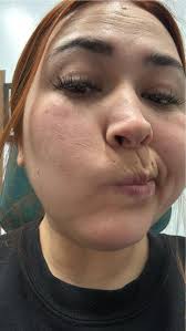 Ok ladies sorry for the picture I feel ugly myself I need help how to make  these wrinkles go away and my skin I'm 6 months pregnant and my face feels  dry