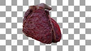 Coronary artery bypass surgery — heart bypass redirects here. Coronary Arteries Diagonal Arteries Stock Video Clip K009 6442 Science Photo Library