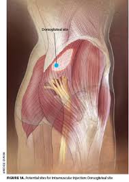 Image result for Intramuscular Injection