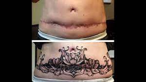 A very creative and personal way to embrace your caesarean scar. C Section Cover Up Tattoos Befor After Youtube