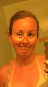 this year if Sun doesn't allows me to shine I will going to apply hot fire  🔥 😤