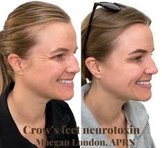 When a patient trusts me with more than lips and tox, the best results are  delivered! Aesthetic medicine has really come so far & the way I treat  patients is so different