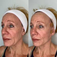 Mayra Gamboa BSN, RN