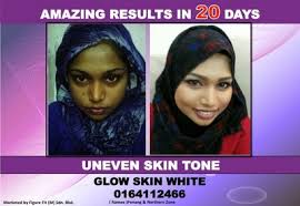 The secret to healthy, radiant, clear, glowing skin is actually really simple: Glow Skin White Glow Skin White