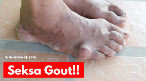 Sejumlah gejala yang bisa muncul saat hendak menstruasi seperti berjerawat, kram perut, hingga perubahan mood. Ubat Gout Shaklee