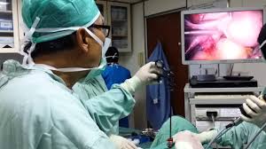 Dokumen, saya ingin bertanya, bapa mertua saya terkena hernia. Ubat Dan Rawatan Pembedahan Kehamilan Ektopik Perancangan 2021