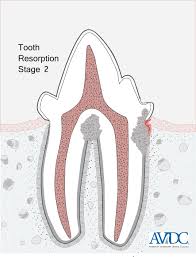 Avdc Nomenclature Avdc Org