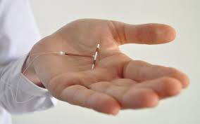 This is not a complete list of side effects and others may occur. 7 Reasons To Love Iuds One Medical