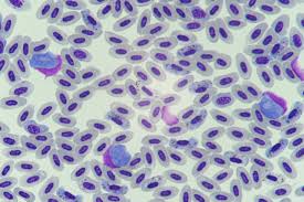 Segmentasi merupakan langkah penting pada proses deteksi. Researchers Build Most Comprehensive Tree Of Life For Malaria Parasites Eurekalert Science News