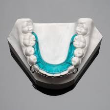 Colores de brackets para mujer. Traditional Retainer Ortodoncia Brackets Dentales Odontologia