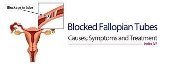 Blocked Fallopian Tubes Causes Symptoms And Treatment