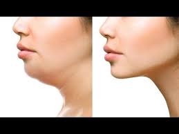 8 ideas de Ejercicios para ciatica