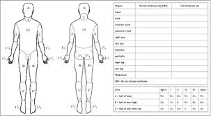 Lund And Browder Chart Download Scientific Diagram