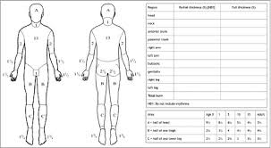 lund and browder chart download scientific diagram