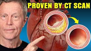 Supporting Learners with Dyslexia with Ivan Newman