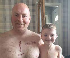 We did not find results for: East Yorkshire Father Gets Surgery Scar Tattoo To Support Son Bbc News