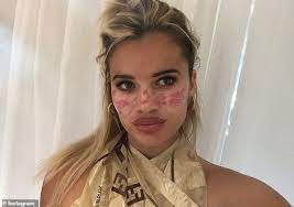 Big brother star tilly whitfeld has revealed it took her 'months' to get over her 'traumatic' exit from the show. Big Brother S Tilly Whitfield Reveals She Was Hospitalised After At Home Acupuncture Procedure Todayuknews