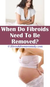 Natural Remedies For Heavy Periods And Fibroids Uterine Fibroids Treatment Uterine Fibroids Fibroid Uterus