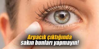 Arpacik Nasil Gecer Panosundaki Pin