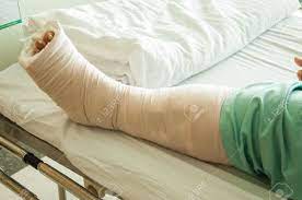 Maybe you would like to learn more about one of these? Woman With Broken Leg In Hospital Stock Photo Picture And Royalty Free Image Image 29674719