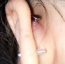 The other is the inner conch, wherein you will get the inner middle part of your ear cartilage pierced. Wildfleisch Bei Piercing Inner Conch Gesundheit Und Medizin Tattoo Helix