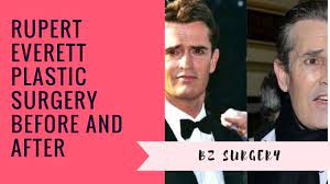 Rupert Everett Plastic Surgery Before and After - YouTube
