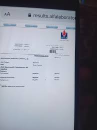 Human serum free of antibodies against t. Ana Weak Positive Ø¯Ù‡ Ù…Ø¹Ù†Ø§Ù‡ Ø§ÙŠÙ‡